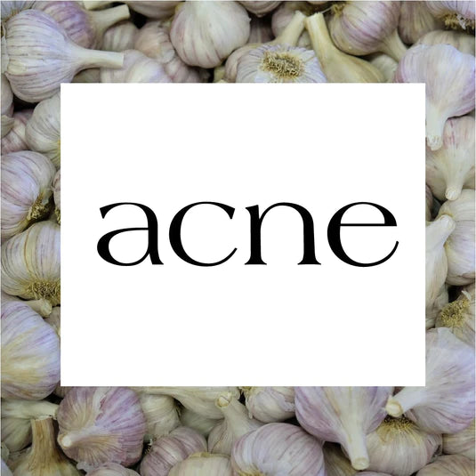ACNE COLLECTION