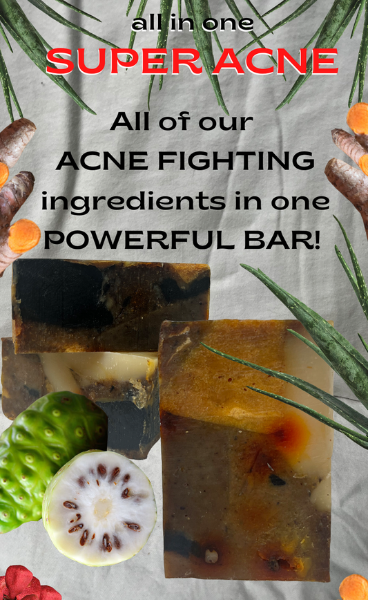 ALL IN ONE SUPER ACNE SOAP